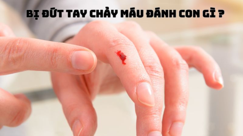 bị đứt tay chảy máu đánh con gì ? 